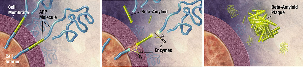 Enzymes act on the APP (Amyloid precursor protein) and cut it into fragments of protein, one of which is called beta-amyloid and is crucial in the formation of senile plaques in Alzheimer. (Courtesy of derivative work: Garrondo (talk). ADEAR: "Alzheimer's Disease Education and Referral Center, a service of the National Institute on Aging.", Public domain, via Wikimedia Commons