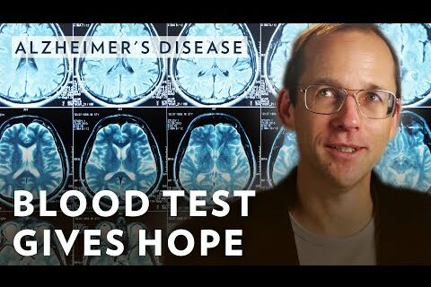 Alzheimer's Blood Test Gives Hope